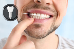 Dental Implants Vs. Bridges In Westchase & Trinity