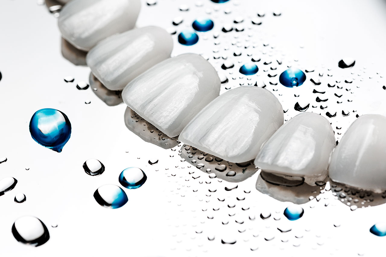 Porcelain Veneers In Tampa And Trinity: A Natural Looking Smile Upgrade With Predictable Results
