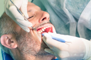 New Patient Dental Exams In Tampa And Trinity: What To Expect At Your First Visit