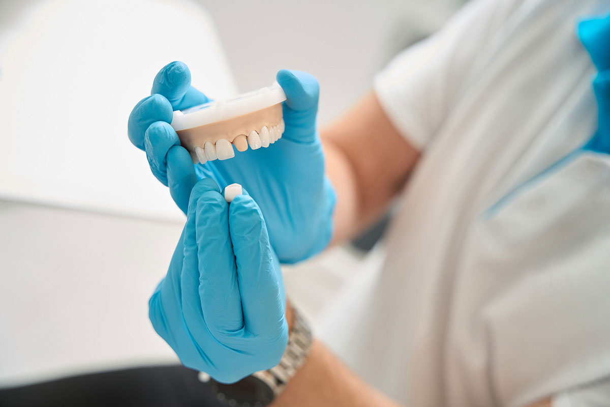 Loose Or Lost Dental Crowns In Tampa And Trinity: What To Do And When To Seek Treatment